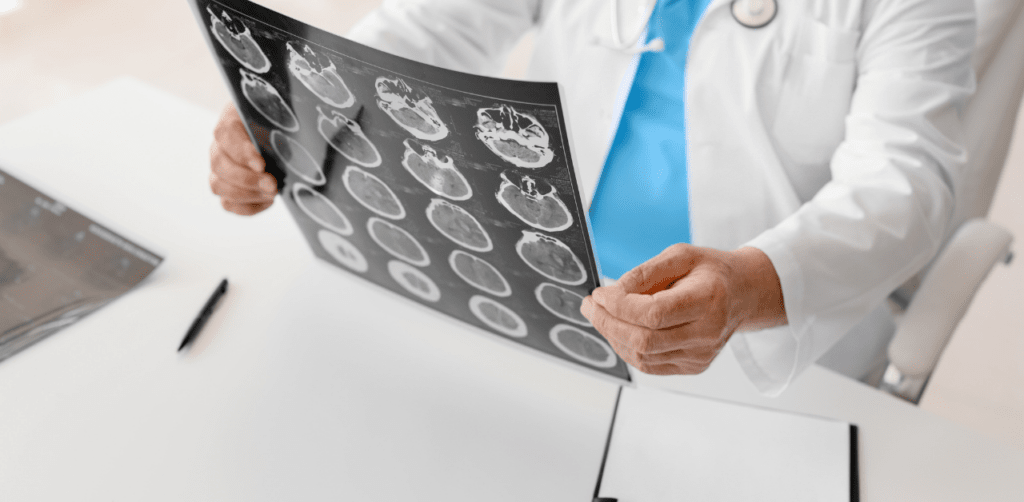 Doctor in a white coat holds and examines a brain scan, with a pen and notepad on the desk