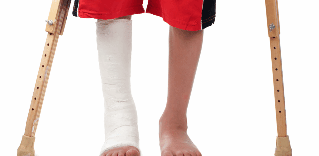 Child wearing red shorts using wooden crutches with a white plaster cast on one leg